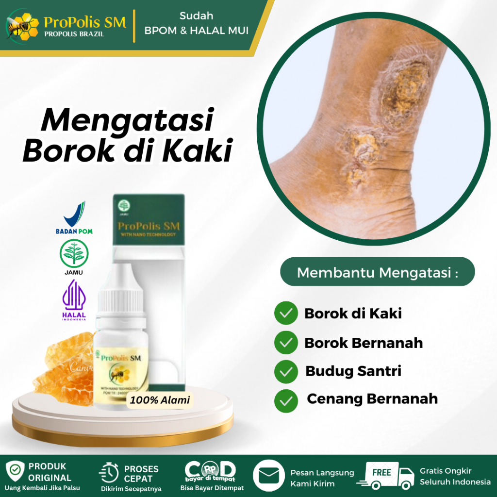 Salep Oles Untuk Borok di Kaki, Borok Bernanah, Budug, Cenang Bernanah, Borok di Kepala, Kulit Gatal