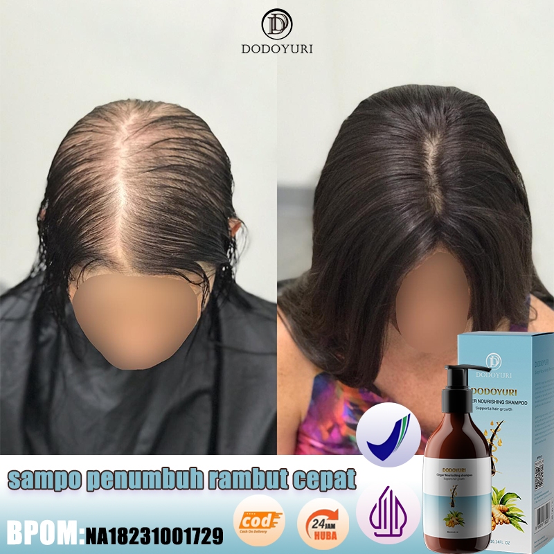 Shampoo penumbuh rambut cepat Shampoo rambut rontok Sampo pemanjangan rambut cepat 300ml Sampo penum
