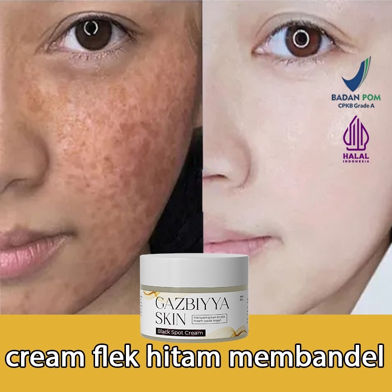 Krim Bintik Hitam Membandel bpom Krim Penghilang Bintik Hitam Serum Bintik Hitam Membandel 30g Krim 