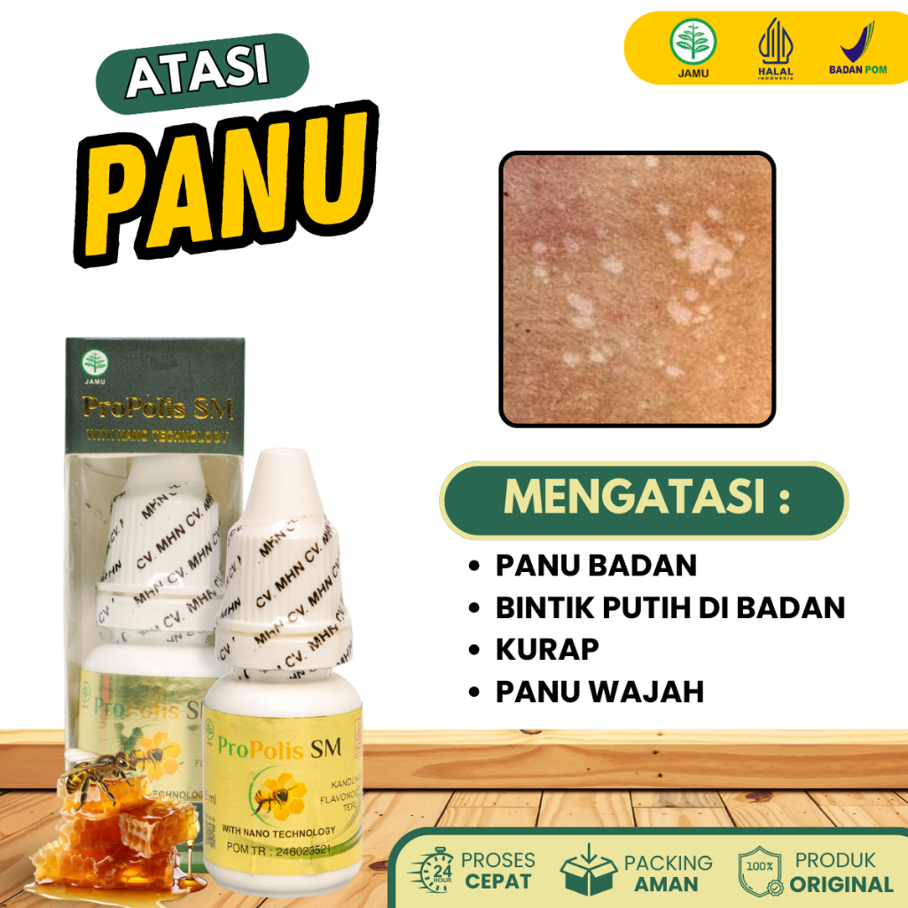 Propolis Sm - Obat Panu, Obat Panu Di Wajah Obat Panu Di Badan, Obat Bintik Putih Di Badan , Obat Ha