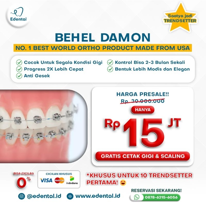 Paket Behel Damon