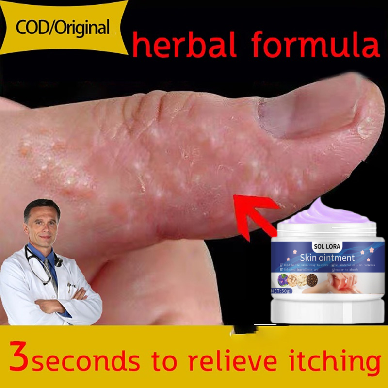 50g salep gatal salep gatal paling ampuh salep gatal obat gatal selangkangan obat selangkangan gatal