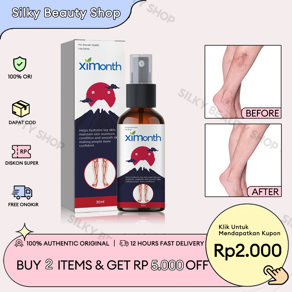 Ximonth Varicose Veins Spray 30ml Varises Spray Salep Varises Vaskulitis Flebitis Pengobatan Pengoba