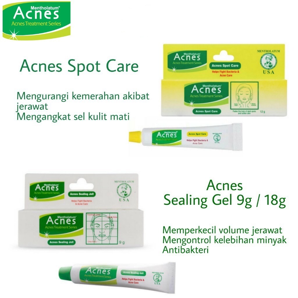 ACNES TREATMENT SERIES