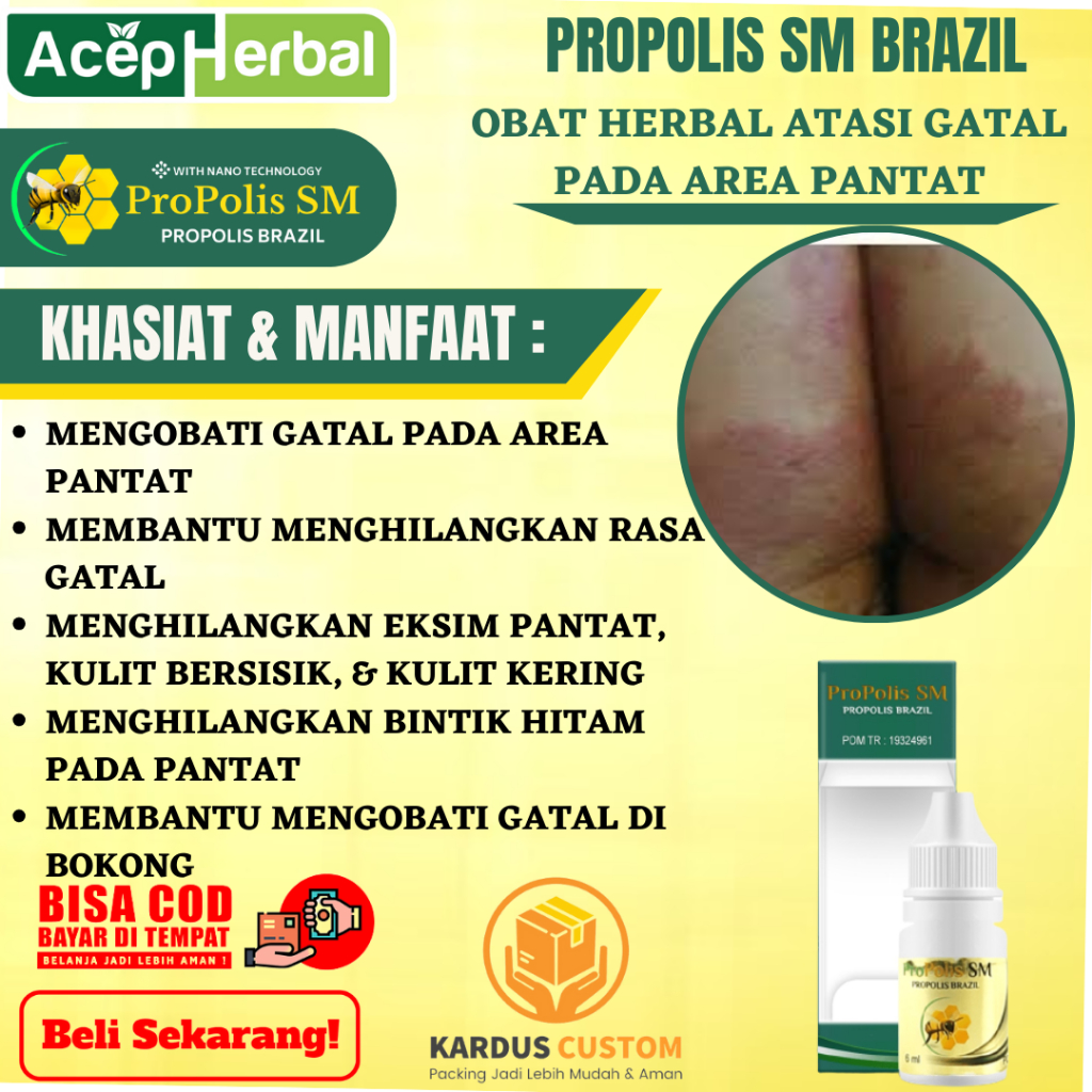 Obat Gatal Pantat, Pantat Gatal, Menghilangkan Rasa Gatal, Eksim Pantat, Kulit Bersisik, Kulit Kerin