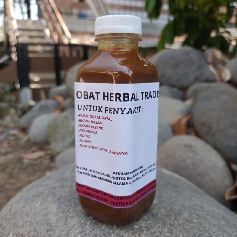 OBAT HERBAL TRADISIONAL RACIKAN KHUSUS PENYAKIT EKSIM ,PSORIASIS ,KUDIS ,KURAP ,KULIT GATAL GATAL