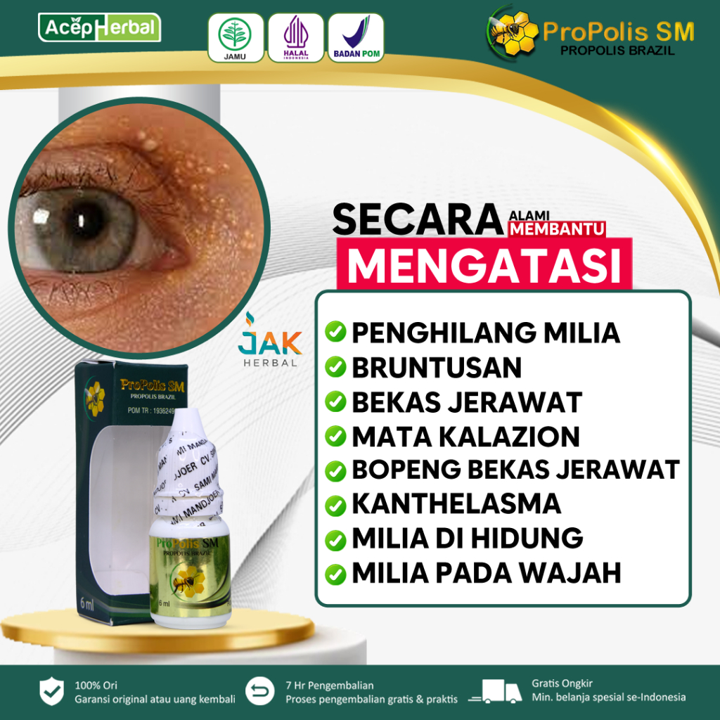 Obat Penghilang Milia Anak BPOM, Obat Bintik Putih di Milia Bawah Mata, Obat Milia pada Wajah, Obat 