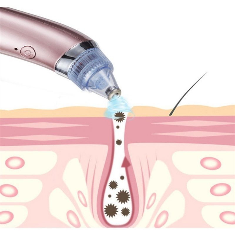 Alat Penyedot Komedo elektrik / Sedot Komedo / Vakum Komedo