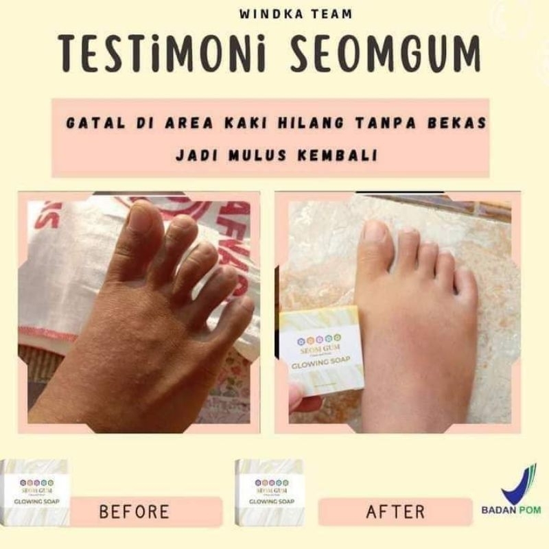 seom gum GLOWING SOAP/sabun multifungsi