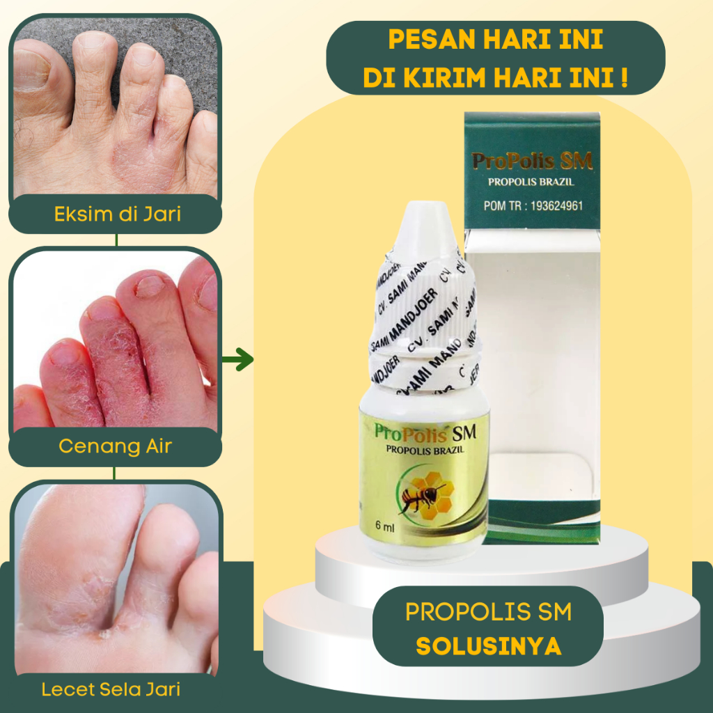 Obat Jari Kaki Pecah Pecah, Obat Jari Kaki Gatal Dan Mengelupas, Obat Kaki Altet, Jamur Kuku, Obat K