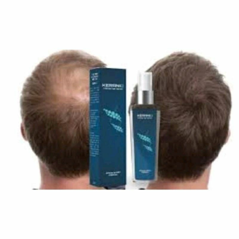 Penumbuh Rambut KERANIQ Original Hair Serum Penumbuh Rambut Rontok