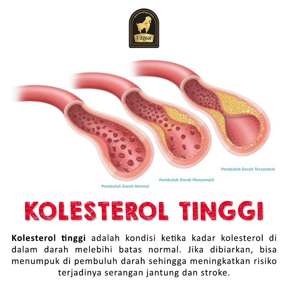 

Fitgoat - Susu Kambing Etawa minuman sunnah herbal dengan habbatussauda dan Selenium yang mampu mengatasi Kolesterol