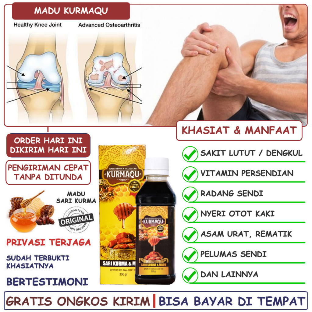 Obat Persendian Lutut Dan Dengkul Sendi Lutut Sakit Radang Sendi Lutut Osteoarthiritis Nyeri Otot Ka