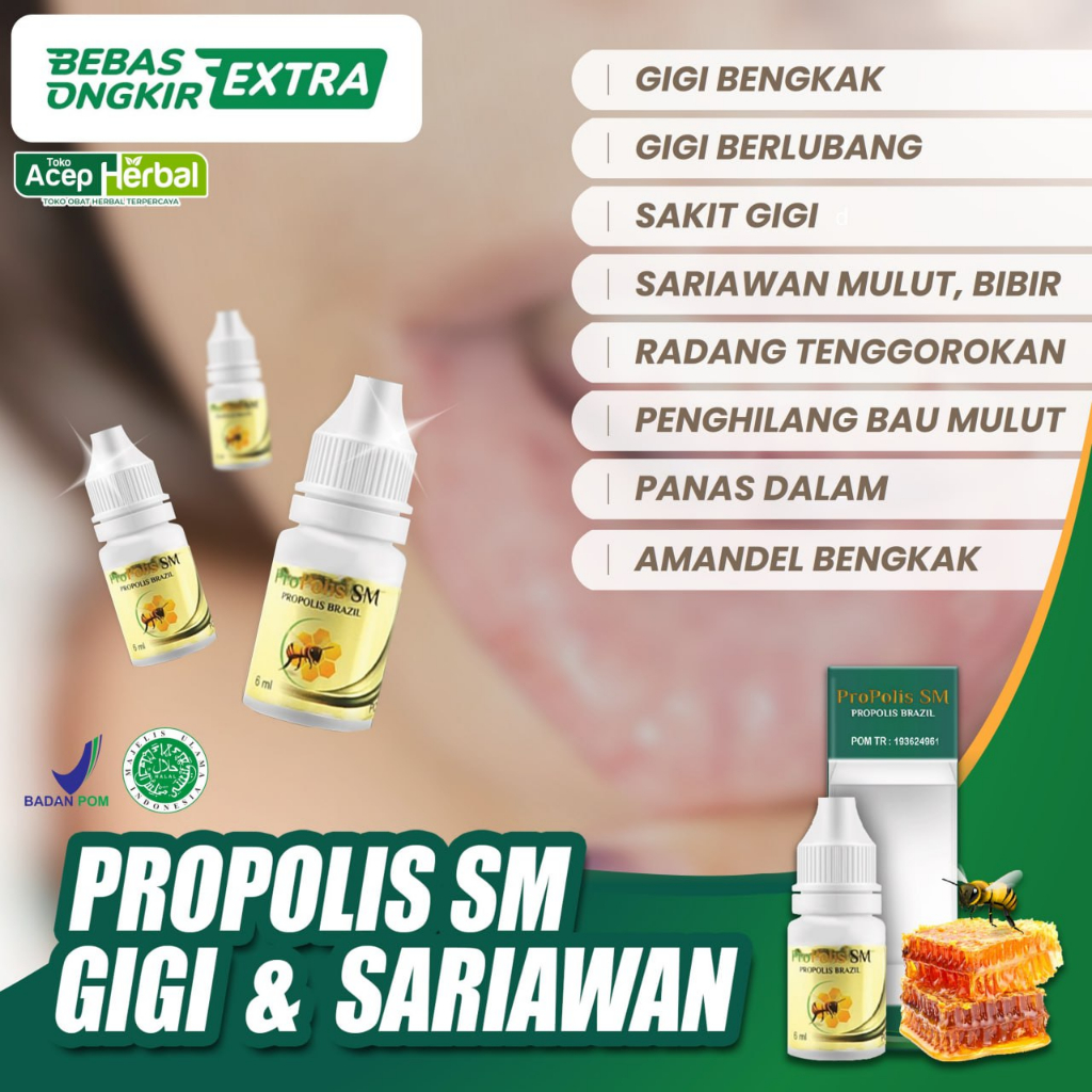 Obat Sakit Gigi Berlubang Obat Sakit Gigi Berdarah Obat Gigi Kopong Gigi Keropos Obat Herbal Untuk A