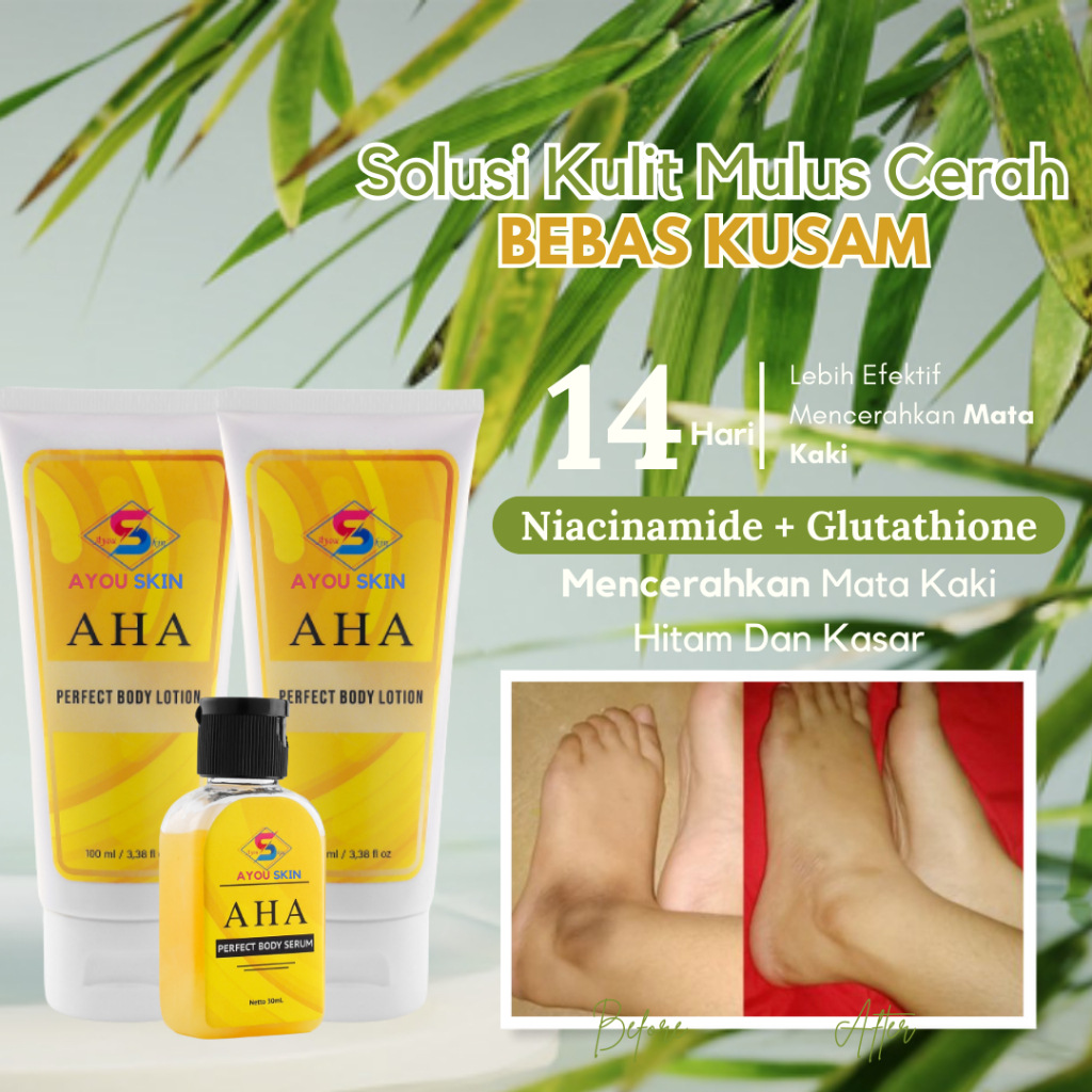 Krim / Cream Pemutih Mata Kaki Hitam, Penghilang Mata Kaki Kering, Mata Kaki Kasar, Lotion Pelembab 