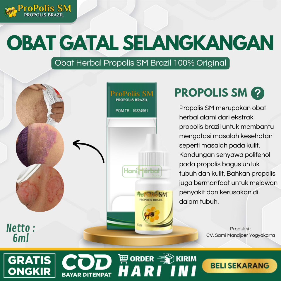 Obat Herbal Untuk Atasi Gatal Selangkangan, Gatal Kemaluan, Selangkangan Berjamur, Selangkangan Lece