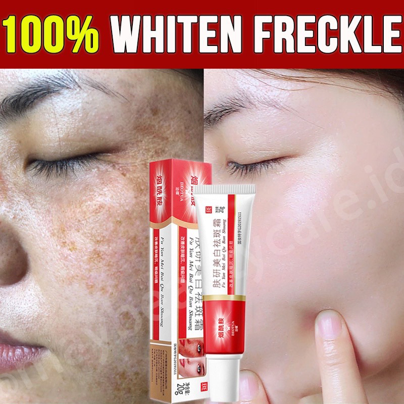 CREAM PEMUTIH WAJAH EFEKTIF - Bintik Hitam - Melasma || 7x Niacinamide 100% Original