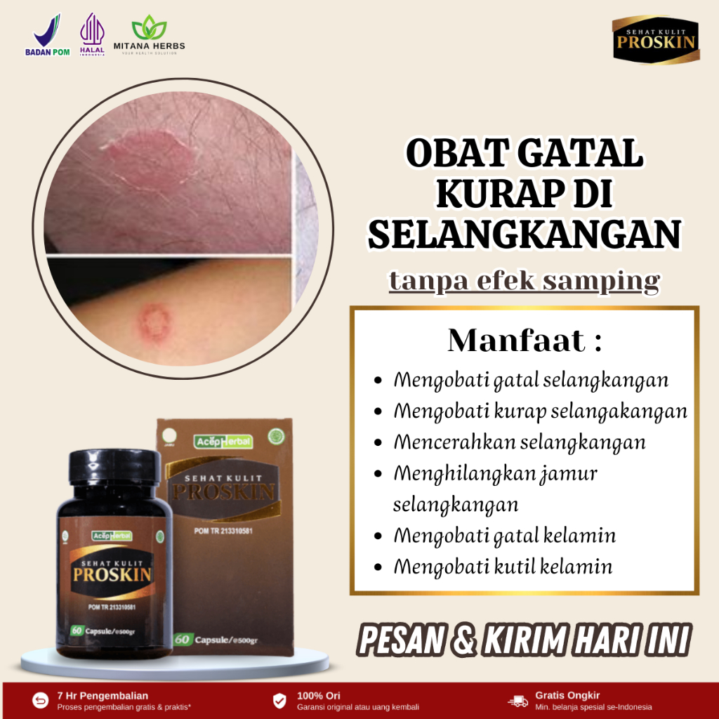 Obat Kurap Selangkangan, Obat Gatal Selangkangan, Obat Selangkangan Gatal Dan Hitam, Obat Gatal Sela