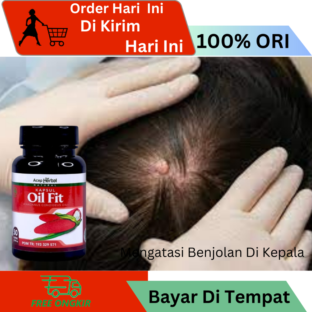 Obat Benjolan Kepala Belakang, Obat Penghilang Benjolan Kepala Belakang, Obat Pengempis Benjolan Di 