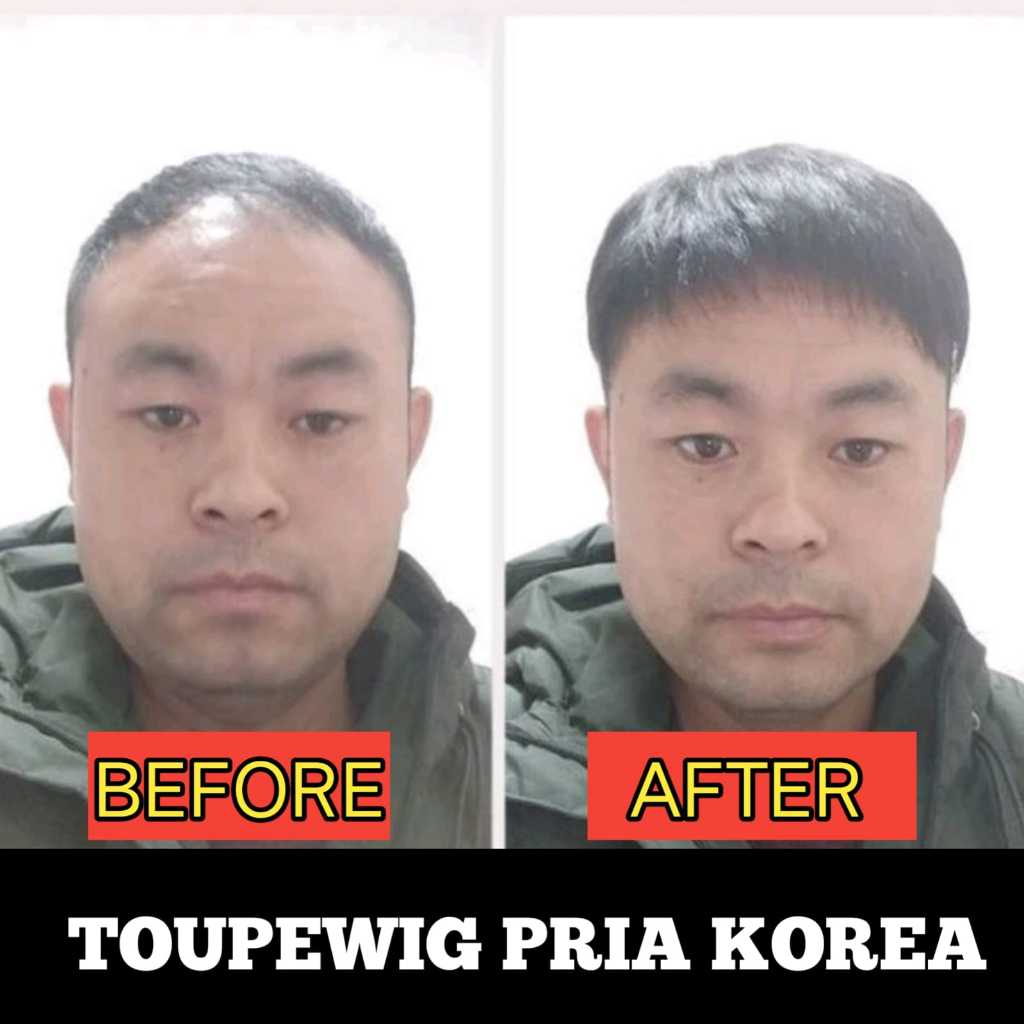 Toupee pria sejati Anti Kebotakan Wig Pria Penutup Botak Rambut Pendek Warna Hitam