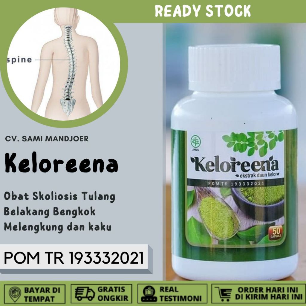 Obat Skoliosis ,Obat Tulang Belakang Bengkok, Tulang Belakang Bengkok dan Melengkung, Obat Tulang Pu