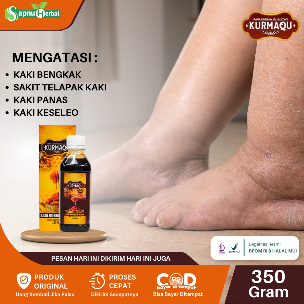 Obat Kaki Bengkak Kaki Bengkak Diabetes Saraf Penyumbatan Darah Ginjal Jantung Liver Terkilir Asam U