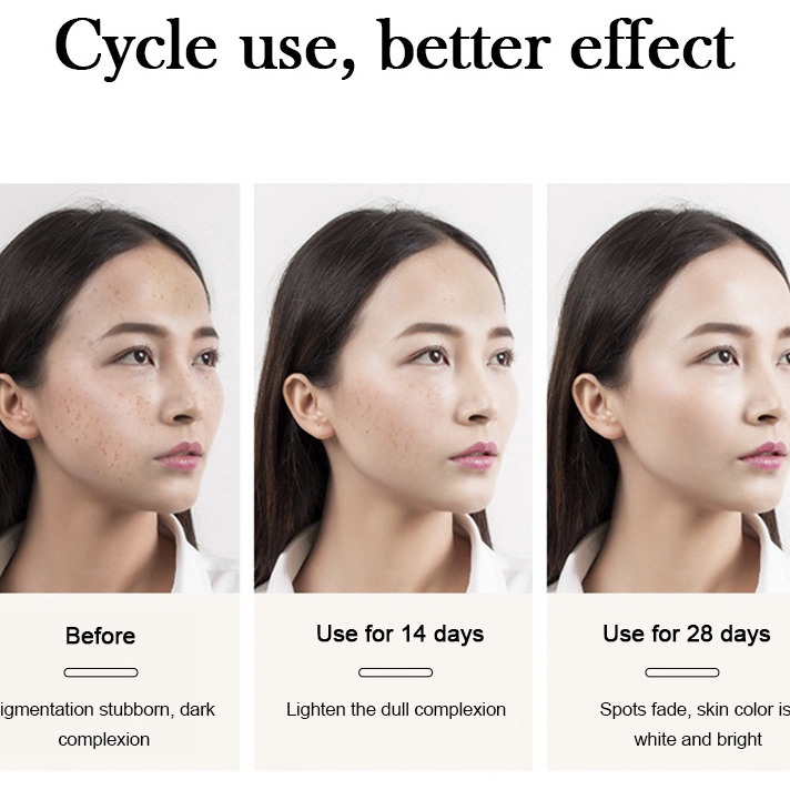 MURAH SK FI DIOR - SK Whitening Freckle Cream Remove Dark Spots Anti Freckle Cream Niacinamide Fade 