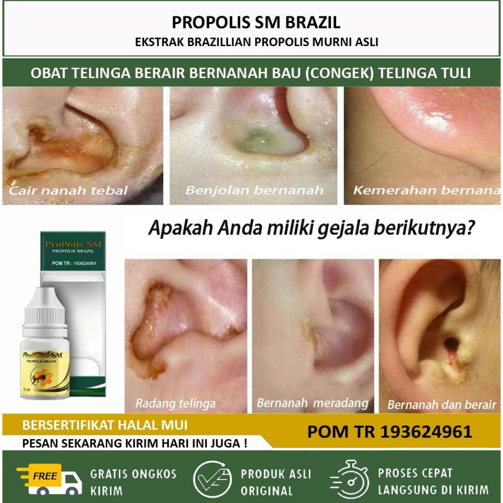 Obat Telinga Bernanah, Obat Telinga Tuli, Obat Telinga Berair / Telinga Tuli Permanen - Obat Telinga
