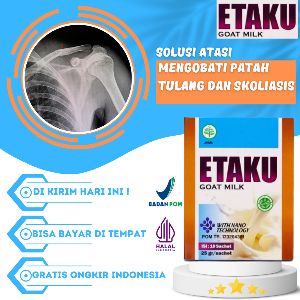 Susu Etaku - Obat Pemulihan Patah Tulang - Obat Osteoporosis - Obat Skoliasis - Obat Keropos Tulang 