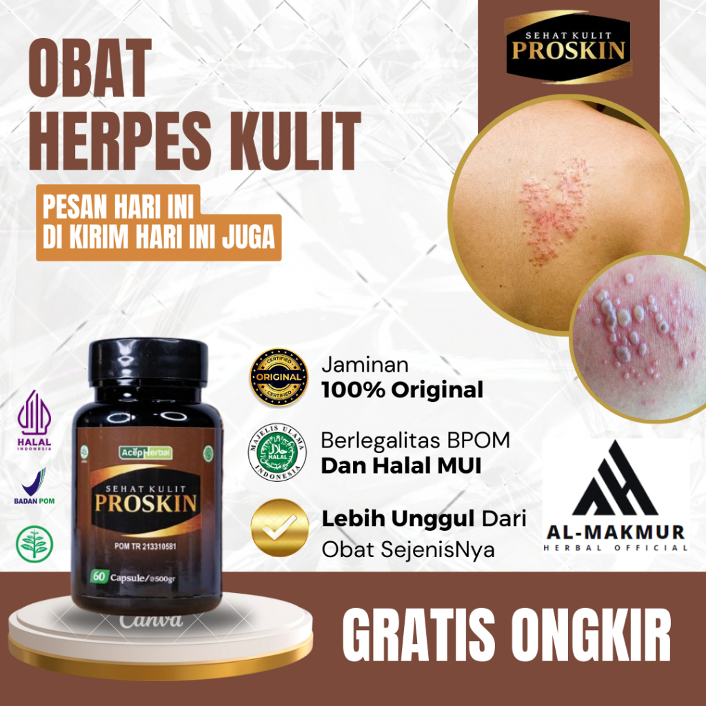 Obat Herpes Kulit, Obat Herpes di Bibir, Obat Herpes di Kelamin, Obat Cacar Api, Obat Cacar Monyet, 