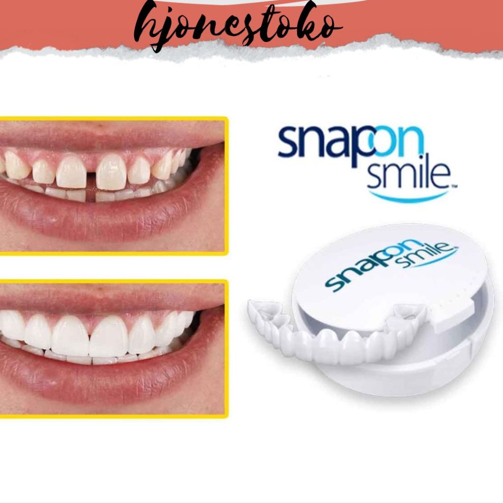 SNAP ON SMILE|SNAP ON SMILE SEPASANG (GIGI ATAS dan GIGI BAWAH)|snap on Smile Gigi palsu atas bawah 