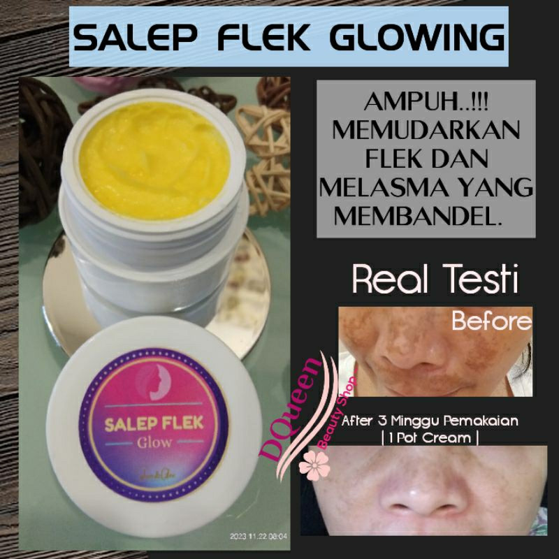 SALEP FLEK AMPUH //CREAM MALAM KHUSUS FLEK MEMBANDEL
