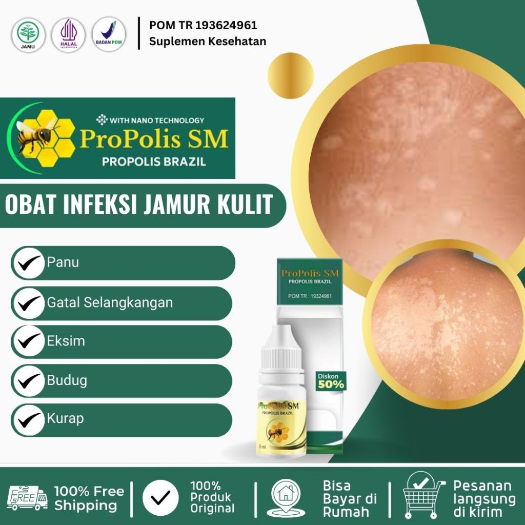 Obat Panu Obat Penghilang Panu Seluruh Badan Obat Jamur Kulit Panu Obat Panu Di Wajah Obat Panu di L