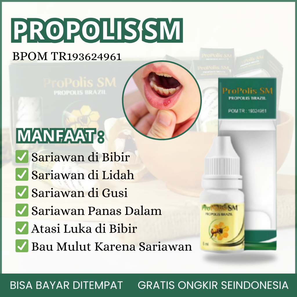 Obat Sariawan, Obat Sariawan di Bibir, Obat Sariawan di Lidah, Obat Sariawan di Gusi, Obat Sariawan 