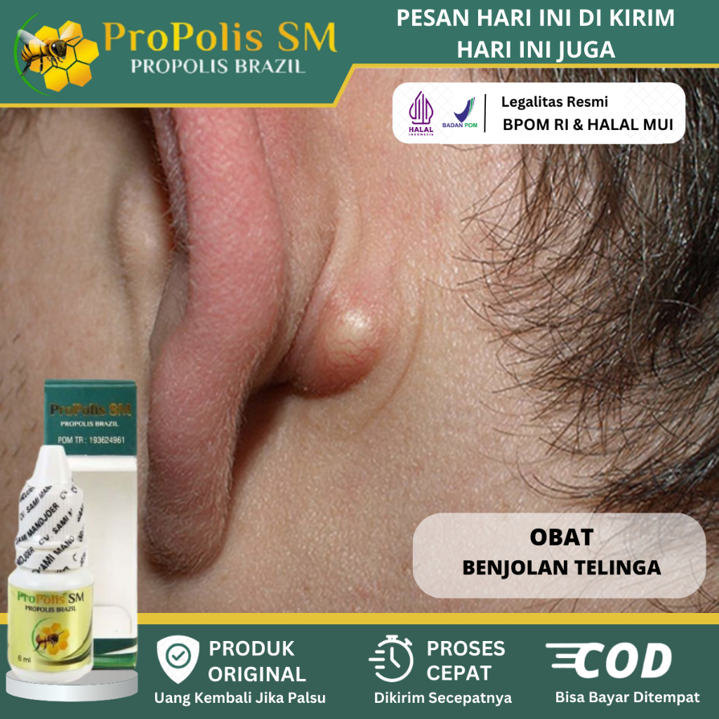 Obat Tetes Herbal Benjolan Di Belakang Telinga, Benjolan di Daun Telinga, Benjolan Di Bawah Telinga,