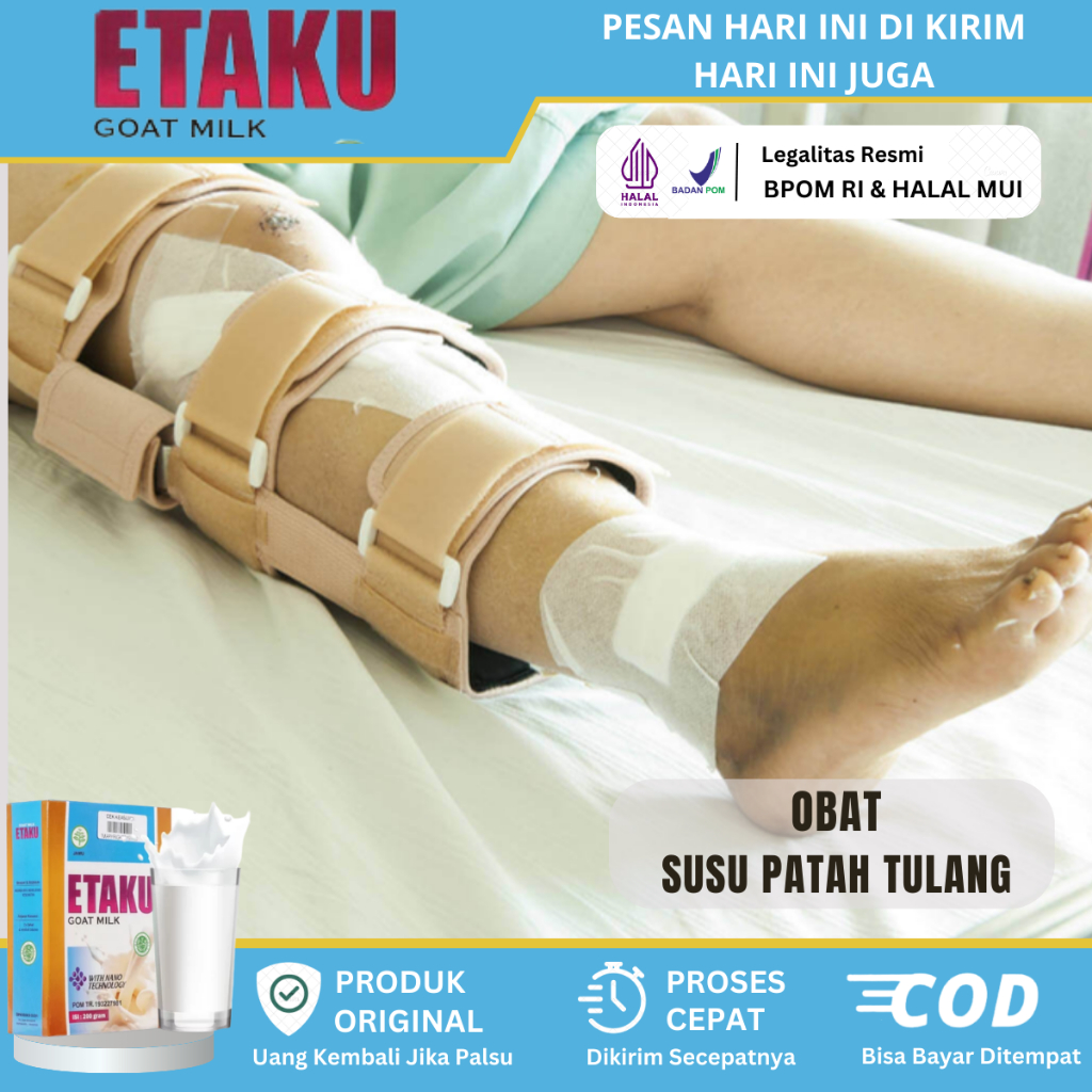 Susu Patah Tulang Dan Retak, Susu Kalsium Tulang, Susu Penguat Tulang Anak, Susu Untuk Patah Tulang 