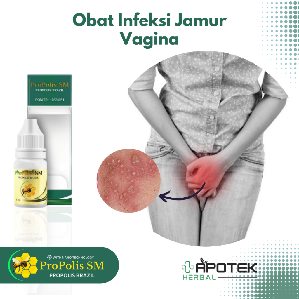 Obat Infeksi Jamur Vagina, Obat Kemaluan Wanita Gatal, Obat Luar Vagina Gatal Gatal Bau, Obat Gatal 