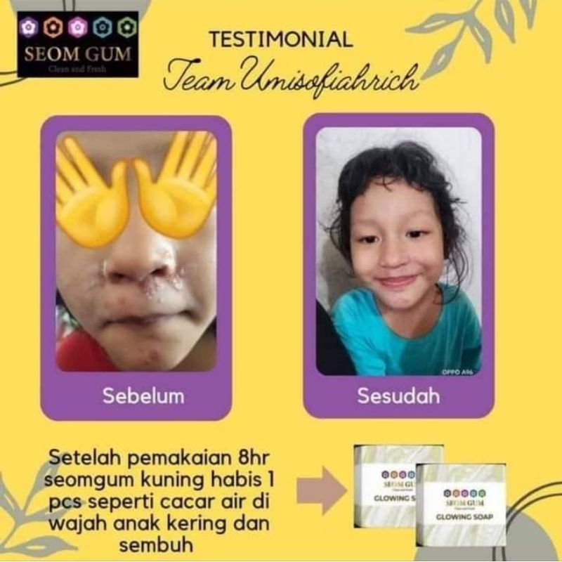 Sabun seom gum Original Sabun Glowing sabun jerawat Feminine soap sabun gatal keputihan