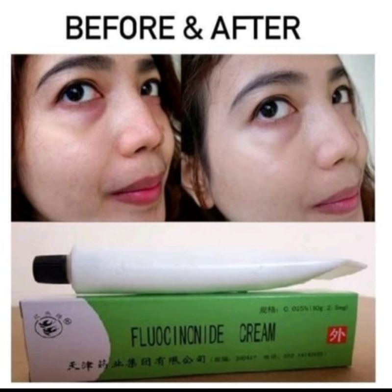 Salep Walet Penghilang Flek Hitam Jerawat Gatal Kudis Kurap Panu