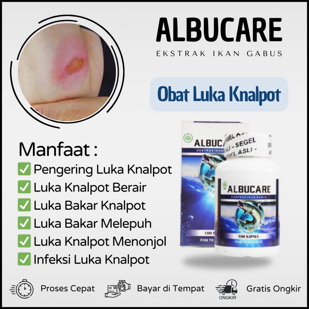Obat Luka Knalpot, Obat Luka Bakar Knalpot, Obat Infeksi Luka Knalpot, Obat Luka Knalpot Berair, Oba
