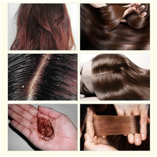 SHAMPO PENUMBUH RAMBUT EXTRAK JAHE | PENUMBUH RAMBUT RONTOK HERBAL | SAMPO PENUMBUH RAMBUT | SAMPO A