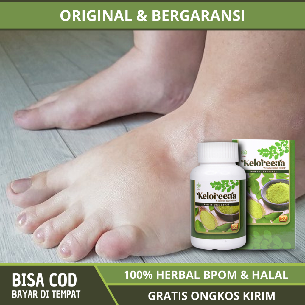 Obat Kaki Bengkak Diabetes Asam Urat Jantung dan Ginjal, Obat Kaki Bengkak Penumpukan Cairan, Obat D