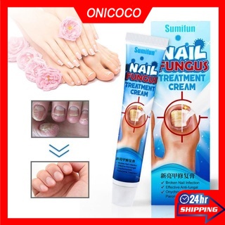 Hot Antibacterial Cream Anti Fungal Cream Nail Fungus Treatment Paronychia Nail Care Repair Ointment