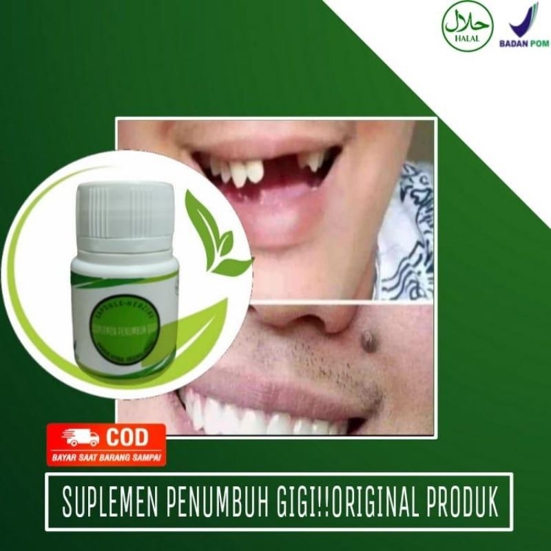 SUPLEMEN PENUMBUH GIGI BOLONG KROPOS DAN OMPONG PERMANEN