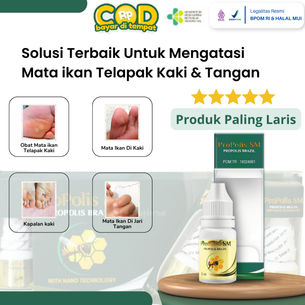 Obat Mata ikan, Obat Mata ikan Telapak Kaki, Obat Mata ikan Di Tangan, Obat Mata Ikan Di Kaki, Obat 