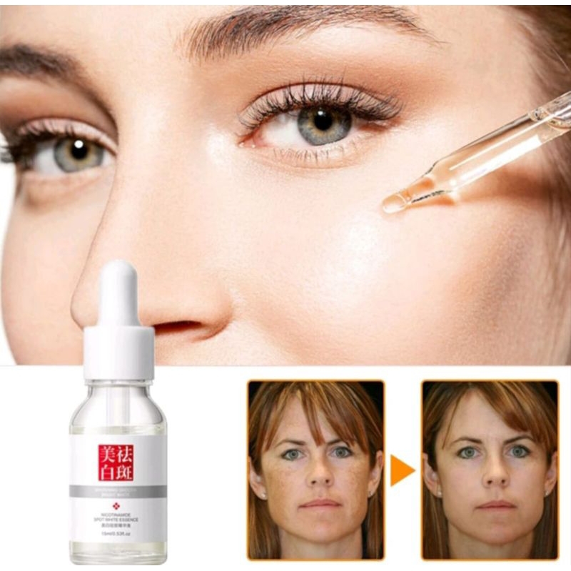 FUYAN Nicotinamide Spot White Essence Serum 15ml