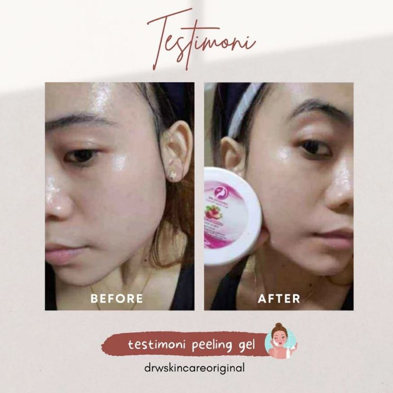 Peeling Gel Drw Skincare/ Exfoliating Gel DRW skincare