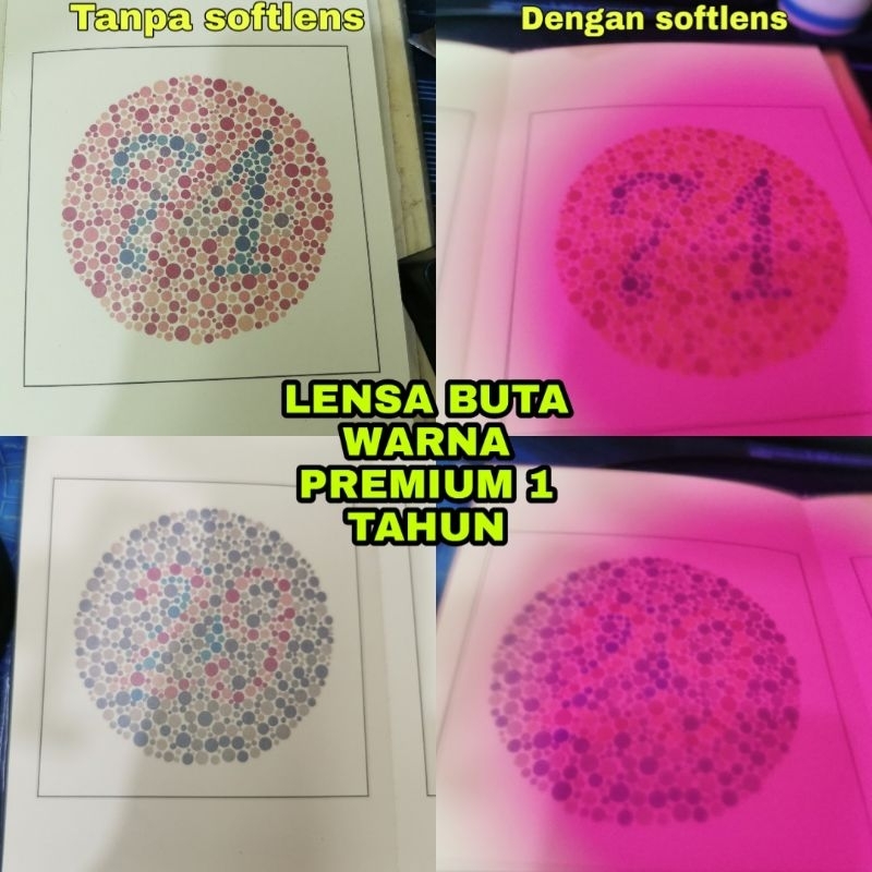 LENSA BUTA WARNA PARSIAL (SOFTLENS BUTA WARNA) - 1 TAHUN (5 TAHUN JIKA SEGEL UTUH)