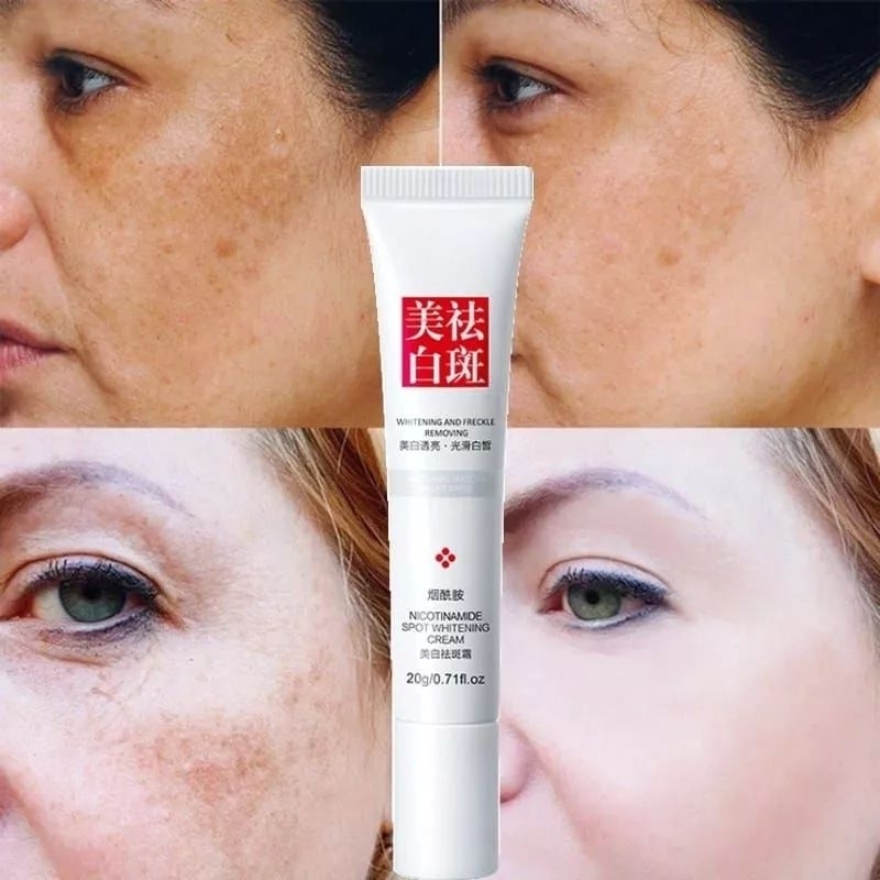 (PROMO ) WHITENING FRECKLE CREAM REMOVE DARK SPOTS  Anti FRECKLE CREAM niacinamide Fade
