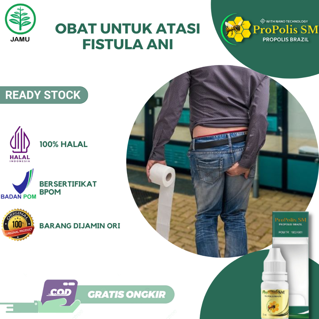 Obat Fistula Ani Bisul di Pantat Nyeri Anus Bengkak Abses Perianal Abses Anus Hemoroid Wasir Ambeien